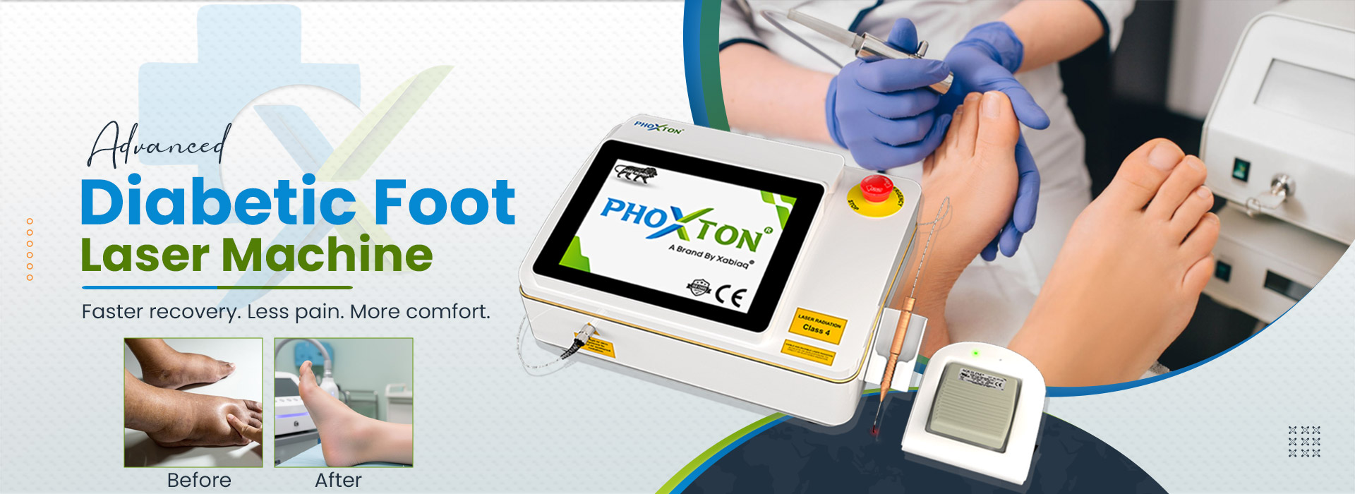  Diabetic Foot Laser Machine